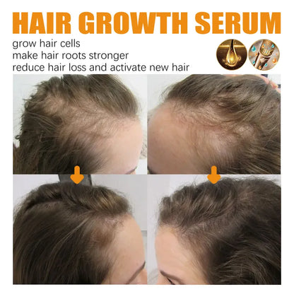 BioPremium